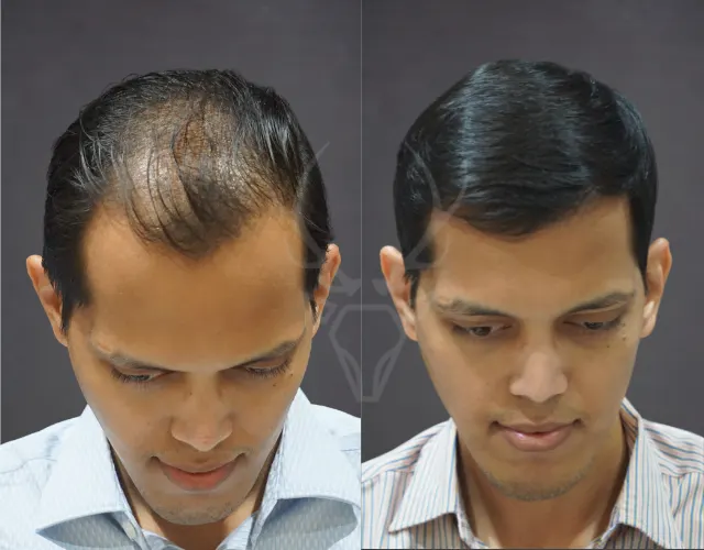 Musk Before - After Results 8