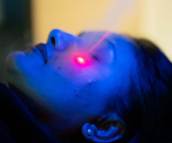 CRYO Facial Treatment (2)