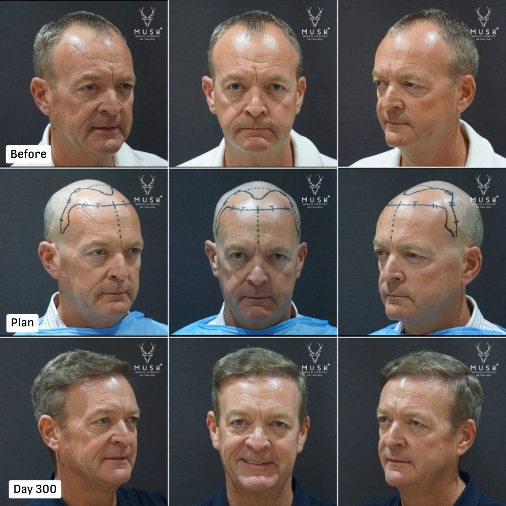 Musk PR Artical Image