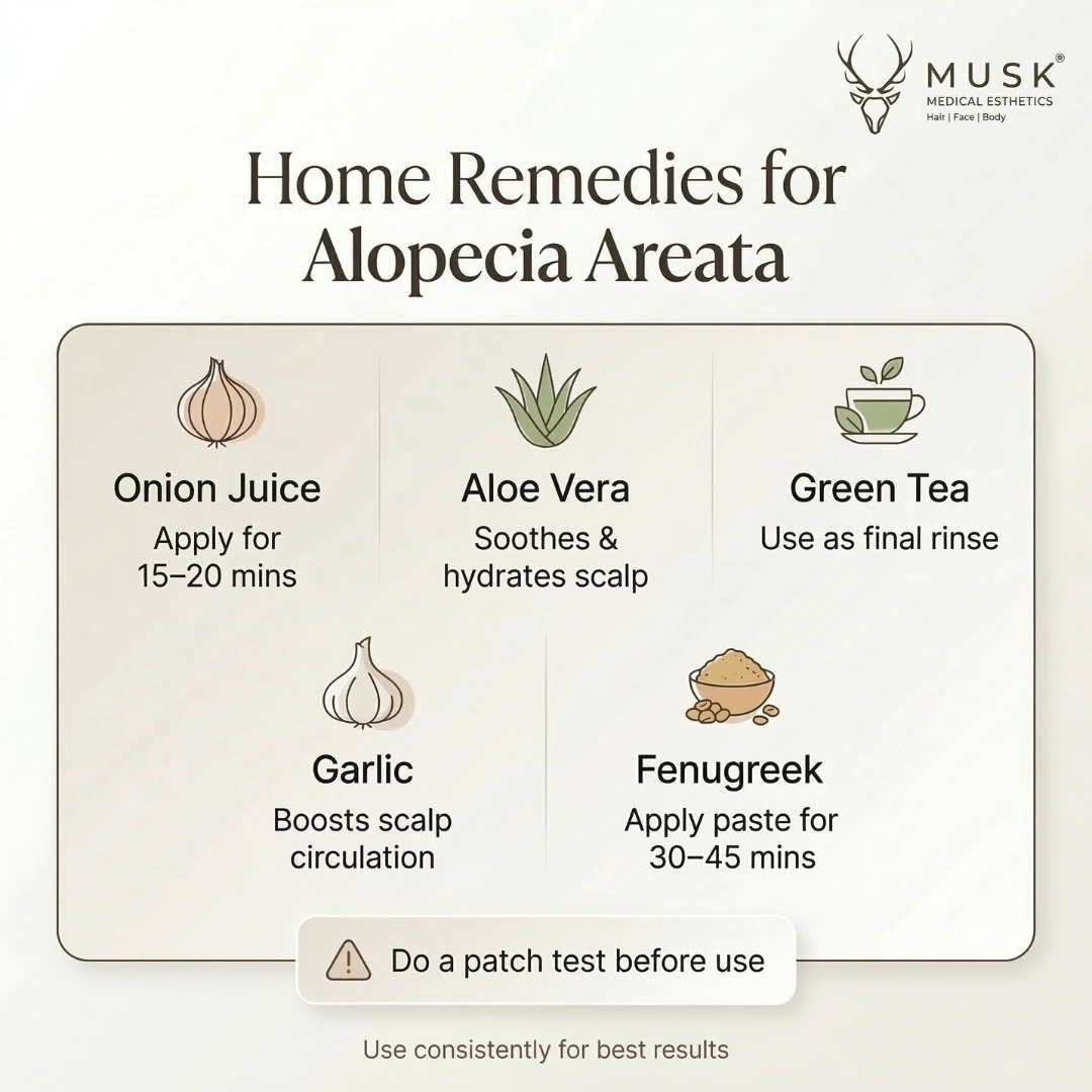 Home Remedies to Treat Alopecia Areata