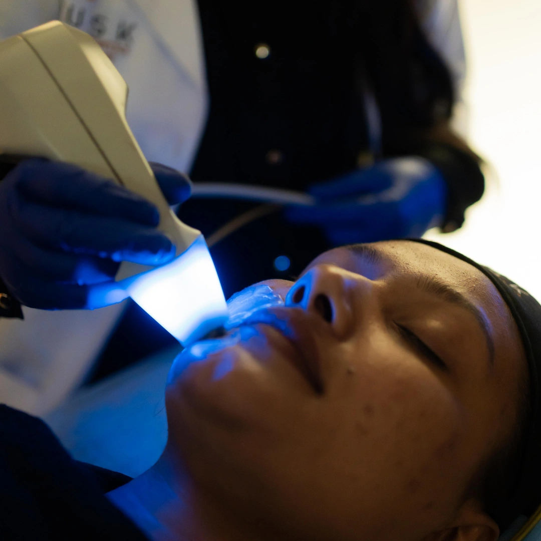 Hot Stone Facelift for Your Skin at Musk Clinic