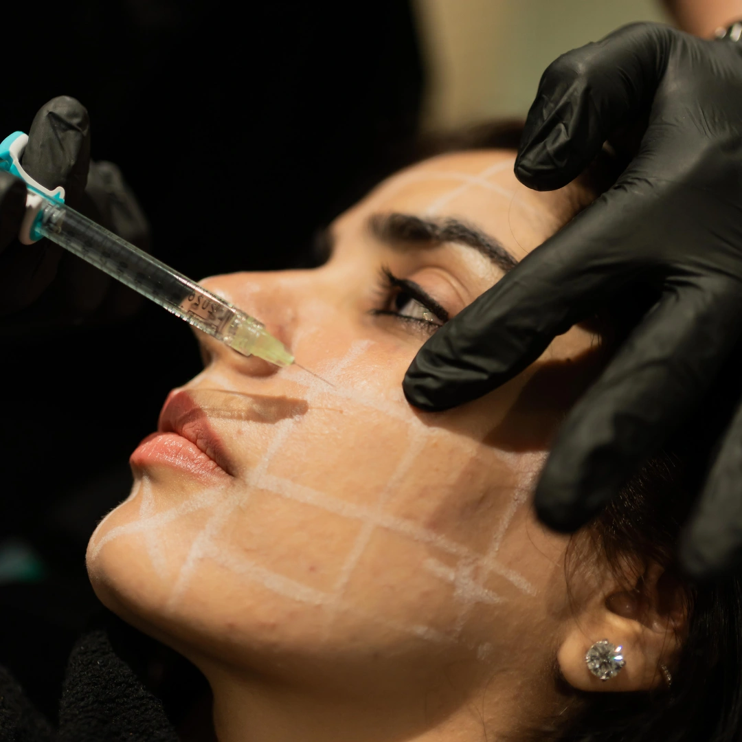 Hydrafacial Treatment Experience at Musk Clinic