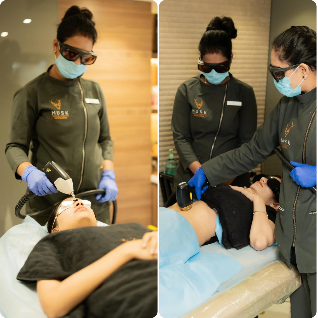 Laser Hair Reduction in Ahmedabad at Musk Clinic