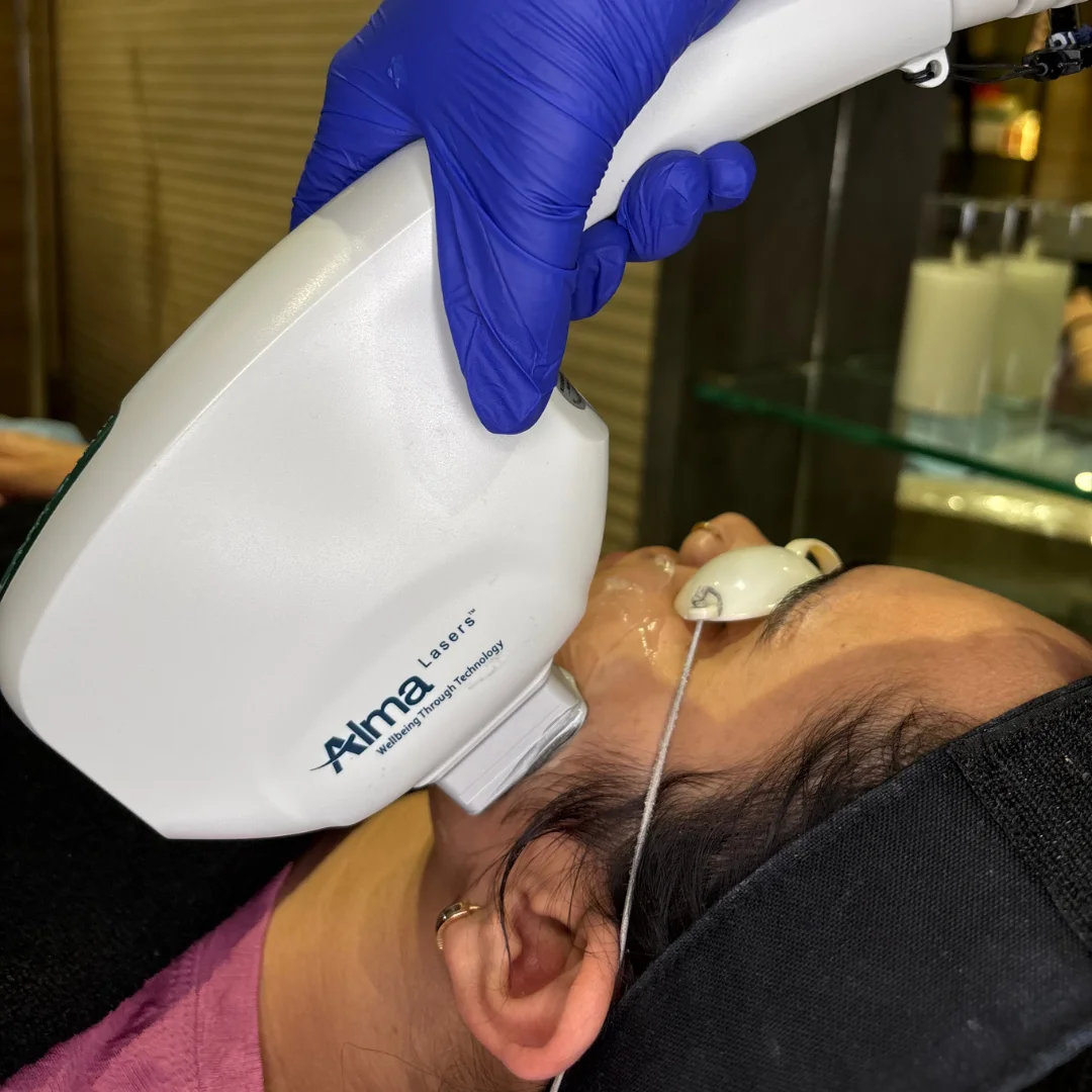 Musk Radiance facial Treatment