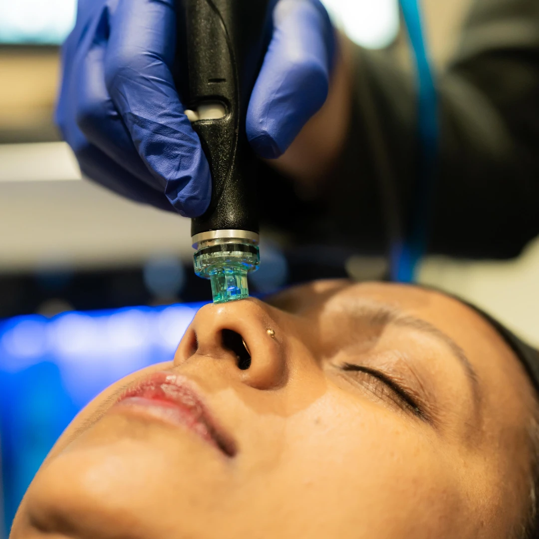 Hydrafacial Treatment – Vortex-Fusion®