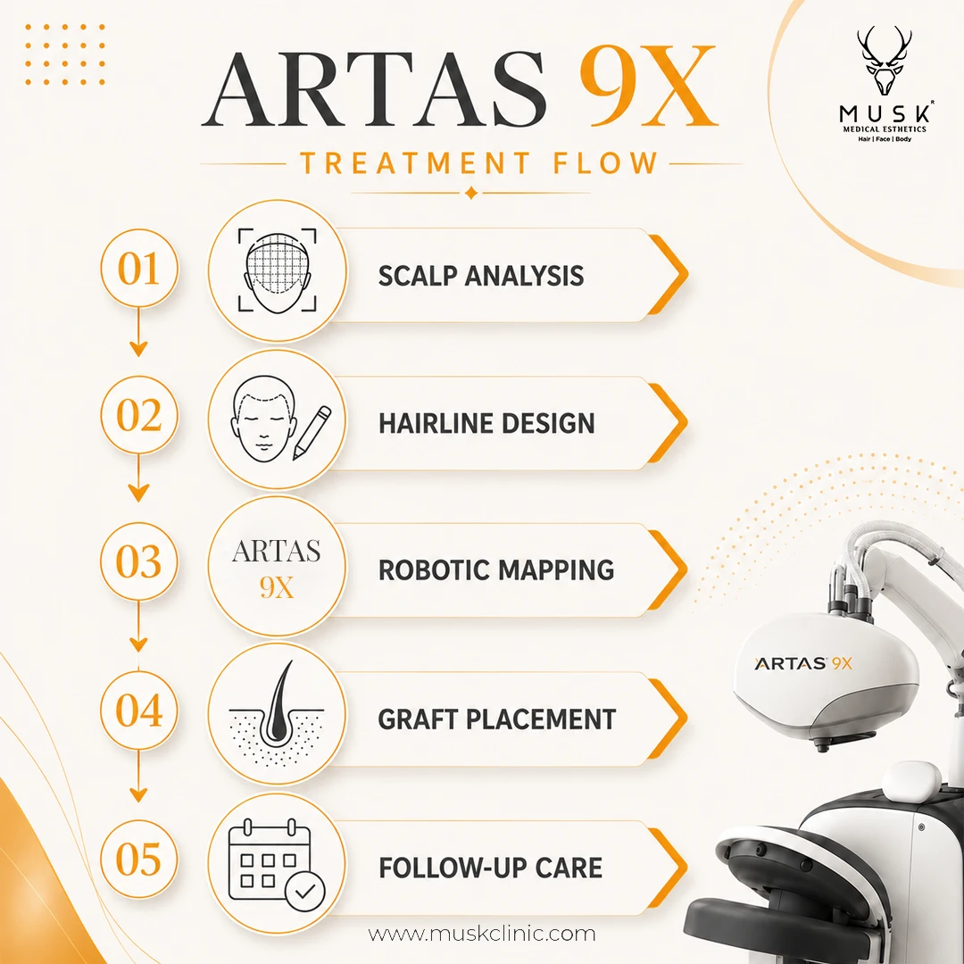 ARTAS 9X Treatment Flow