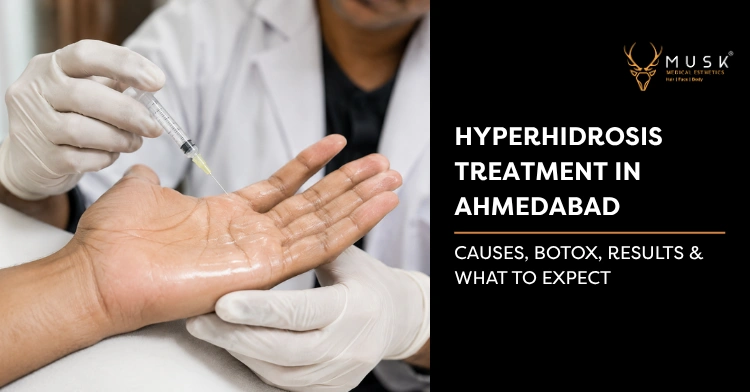 Hyperhidrosis Treatment in Ahmedabad | Botox & Results