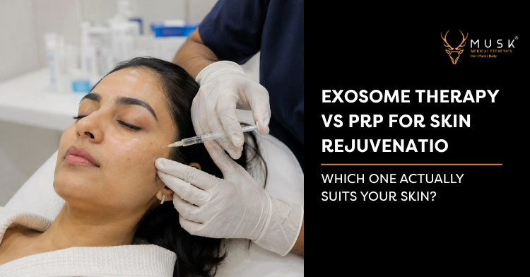 Exosome Therapy vs PRP for Skin Rejuvenation Explained