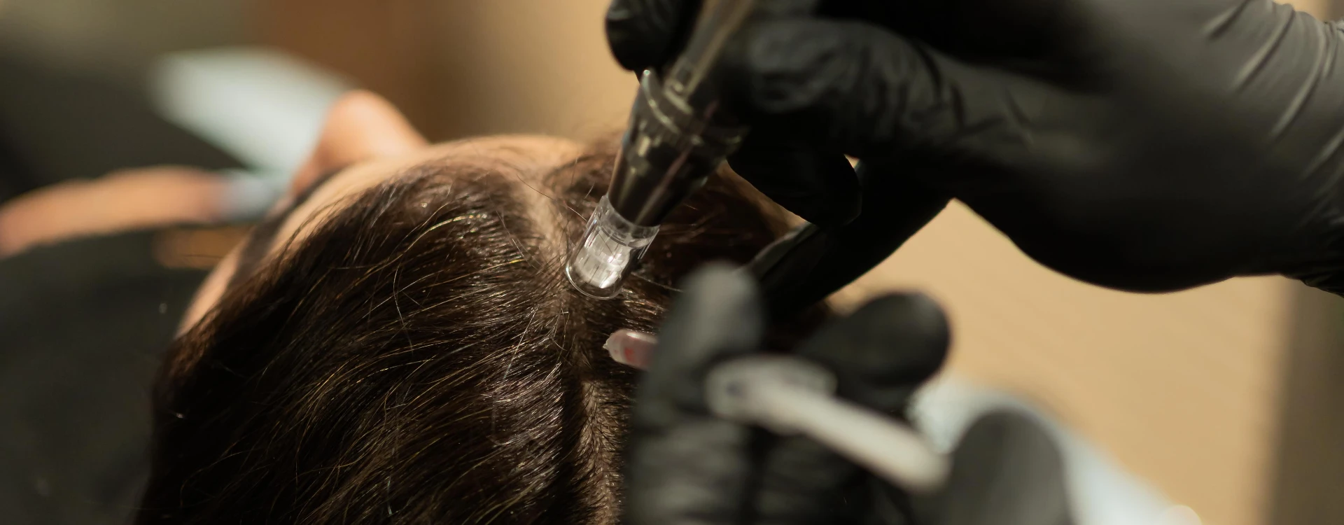 Musk Exosome Therapy Hair®
