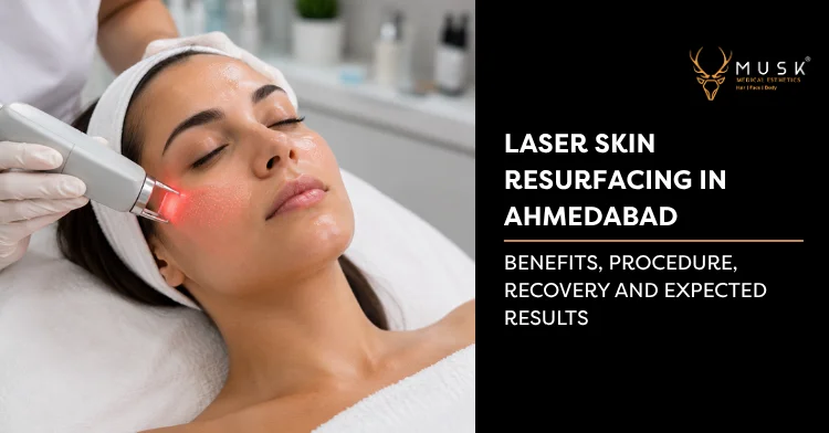 Laser Skin Resurfacing in Ahmedabad: Complete Guide
